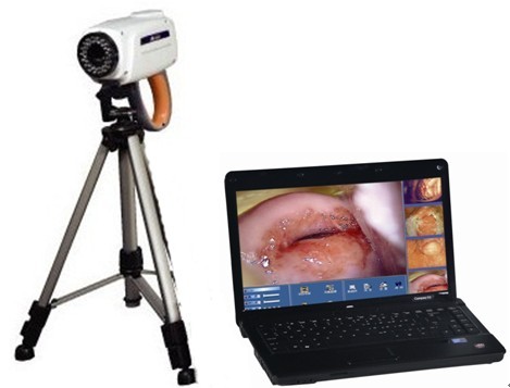 TR6000B digital electronic colposcope(portable)