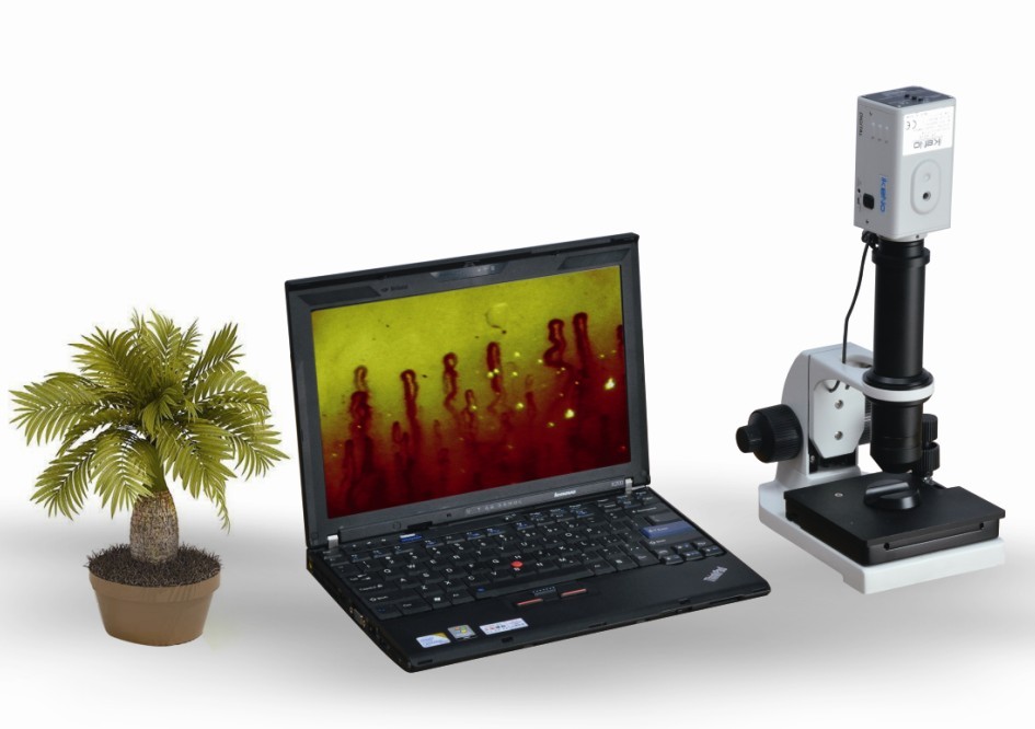 TR8000B Microcirculation Microscope laptop type