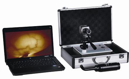 laptop type infrared mammary diagnostic device