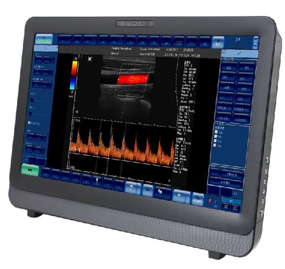 Touch Screen Color Doppler Ultrasound Scanner