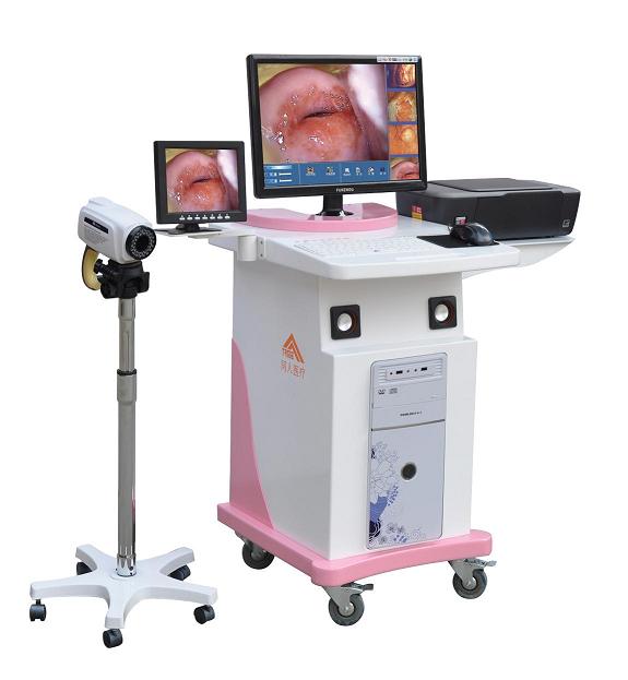 TR6000C dual screen digital electronic colposcope