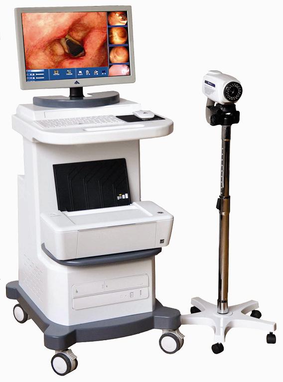 TR-6000D Digital HD Colposcope